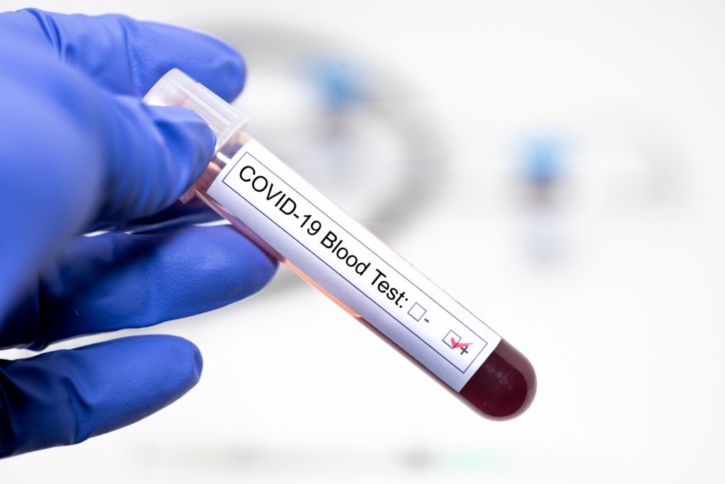 Blood sample labelled as COVID-19 positive